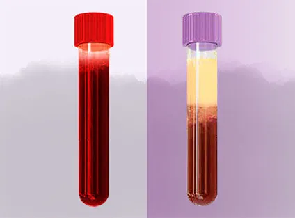 sqf amostra sangues